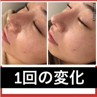 ミディアム パーマ ヘアアレンジ メンズ キッズ ネイル マツエク・マツパ ニキビ・肌質改善専門 ♡人生が変わるサロンのエステ・リラクイメージ