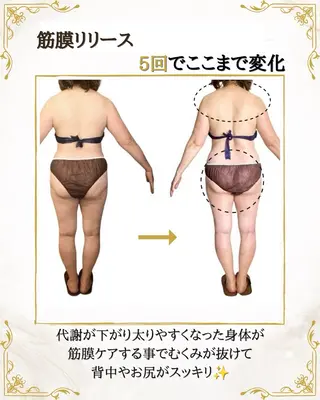 筋膜×深部温熱 リラク★痩身RIONのエステ・リラクイメージ