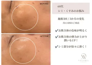 VIVORA ASAMI🌿のエステ・リラクイメージ