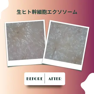 美容と育毛のサロン Link 松浦のマツエク・マツパデザイン
