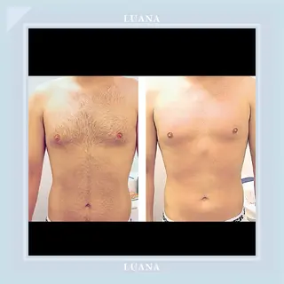 脱毛＆シェービング 専門店LUANAのエステ・リラクイメージ