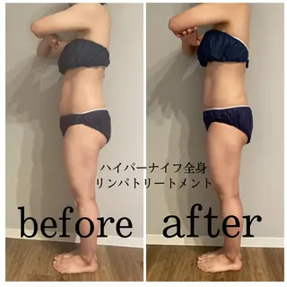 痩身ハイパーナイフ ララピールリアボーテのエステ・リラクイメージ