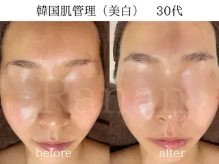 韓国肌管理/眉毛専門 Ranan(ラナン)の眉毛・アイブロウイメージ