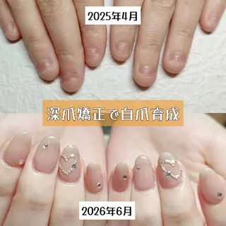 ネイル 深爪矯正/爪育成ケア manie nailのネイルデザイン
