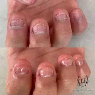 ネイル salon de fika【中崎町】のネイルデザイン
