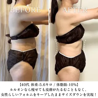 【目黒】本格痩身✴︎ 最新型よもぎ蒸しのエステ・リラクイメージ