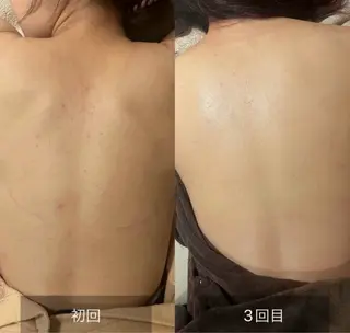 森 美優のエステ・リラクイメージ