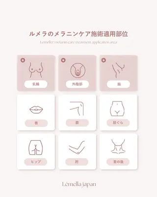 Lovers MOMOのマツエク・マツパデザイン