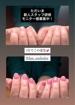 ネイル 深爪矯正専門店 ネイルサロンKUUのネイルデザイン