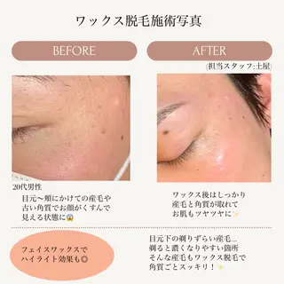 salon de blue五反田 土屋のマツエク・マツパデザイン