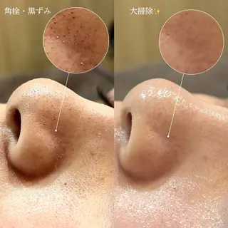 メンズ Suu.今池/千種 眉毛サロンのマツエク・マツパデザイン