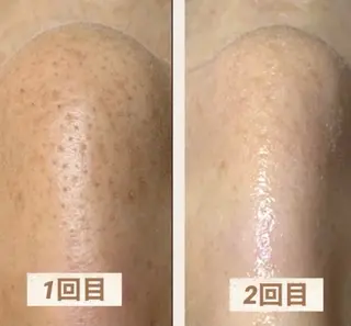 肌改善・リンパサロン CoCoxiaのエステ・リラクイメージ