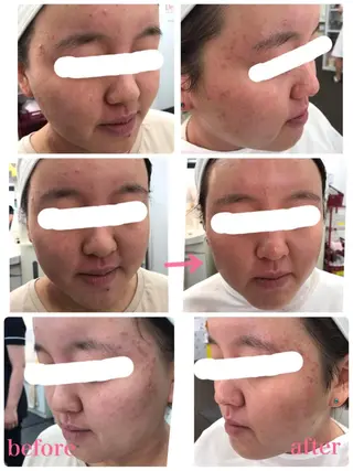 水野 真理◡̈*のエステ・リラクイメージ