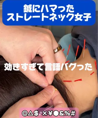 渋谷 小顔美容鍼 専門サロン YZのエステ・リラクイメージ