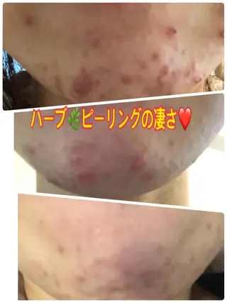 ❤️予約殺到❤️mi オールハンド痩身専門のエステ・リラクイメージ