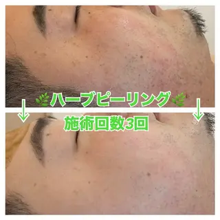 メンズ 脱毛&美容サロン Dr.Epiのエステ・リラクイメージ