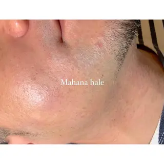 メンズ Mahana haleのエステ・リラクイメージ
