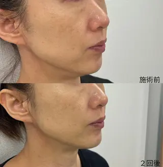 エステサロン Venusのその他イメージ