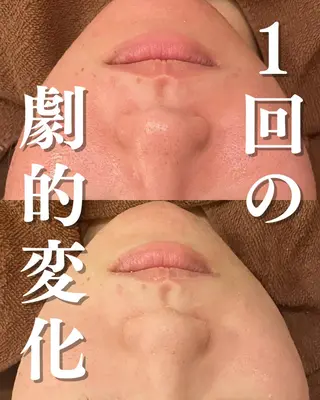 美容まるっと ビヨマルのエステ・リラクイメージ