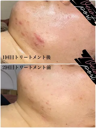 +belle プリュベルのエステ・リラクイメージ