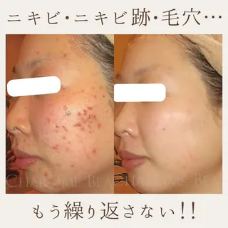 肌質改善サロン renew/ウエキのエステ・リラクイメージ
