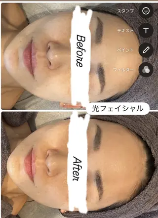 看護師 桐山 まどかのエステ・リラクイメージ