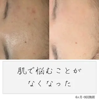 ニキビ経験者が施術 する専門サロン🌻のエステ・リラクイメージ