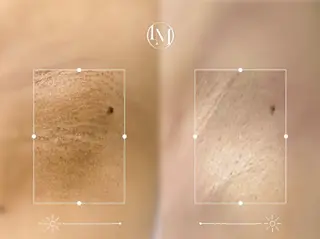 Momo beautyのその他イメージ