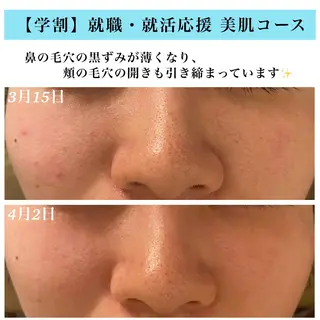 Bellesthe (ベルエステ)のエステ・リラクイメージ