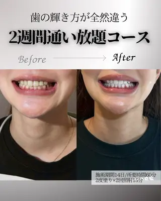 歯科提携エラン ホワイトニング一社店のその他イメージ