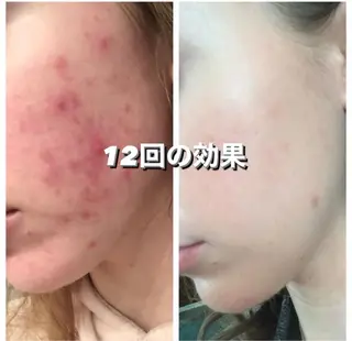 川﨑 杏莉のエステ・リラクイメージ