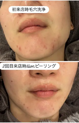 看護師 桐山 まどかのエステ・リラクイメージ