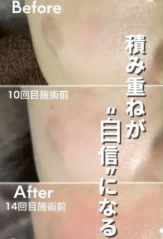 SPOT.com  シミケア専門店のエステ・リラクイメージ