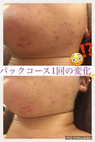 ショート カラー パーマ ヘアアレンジ メンズ キッズ ネイル マツエク・マツパ ニキビ・肌質改善専門 ♡人生が変わるサロンのエステ・リラクイメージ