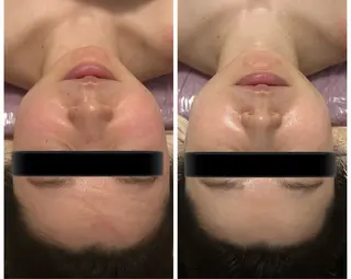 esthetic salon Ranのその他イメージ