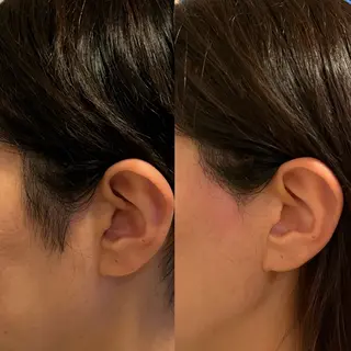 salon Lua🌛のエステ・リラクイメージ