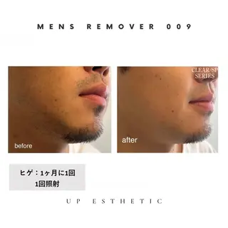 メンズ 韓国肌管理 ウプエステティックのエステ・リラクイメージ