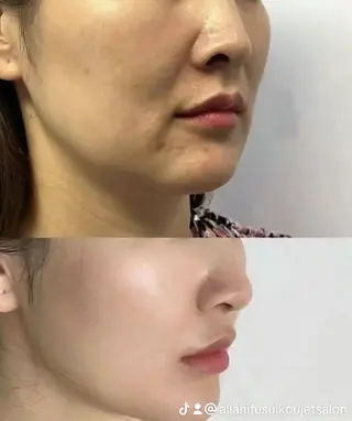 ネイル 愛維美水光専門店 川崎彩鳳のエステ・リラクイメージ