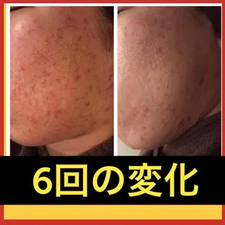 ミディアム カラー パーマ ヘアアレンジ メンズ キッズ ネイル マツエク・マツパ ニキビ・肌質改善専門 ♡人生が変わるサロンのエステ・リラクイメージ