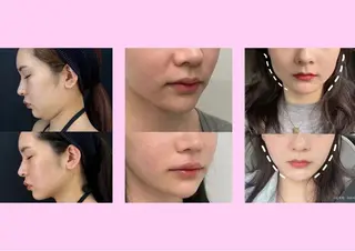 愛維美水光美肌専門店 メンズレディースokのエステ・リラクイメージ