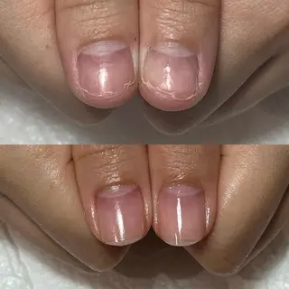 ネイル 自爪育成・巻き爪 補正講師 津蔵のネイルデザイン