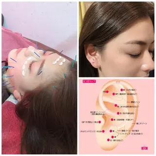 美容鍼灸女性専用 りんご鍼灸治療院のエステ・リラクイメージ