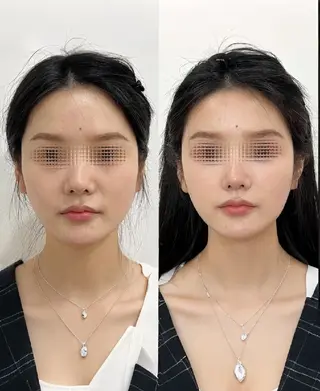 マツエク・マツパ 愛維美水光専門店 川崎彩鳳のエステ・リラクイメージ