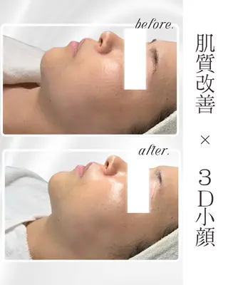 LiAm《韓国管理/ 小顔/脂肪ケア》のエステ・リラクイメージ