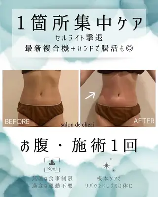 医療提携 肌管理痩身エステ池袋のエステ・リラクイメージ