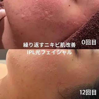 【LEPUS】レプス nishimoriのエステ・リラクイメージ