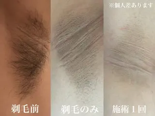 メンズ muumo まりののエステ・リラクイメージ
