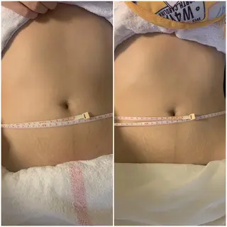 愛維美水光専門店 川崎彩鳳のエステ・リラクイメージ