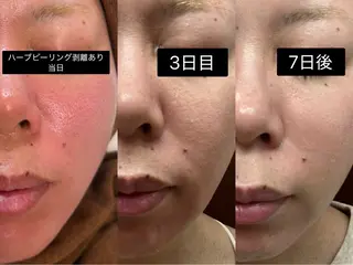 stella 柴山のエステ・リラクイメージ