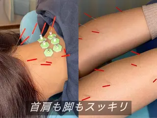 渋谷 小顔美容鍼 専門サロン YZのエステ・リラクイメージ